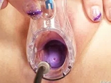 Zaneta has her pussy gyno speculum examined by old doctor